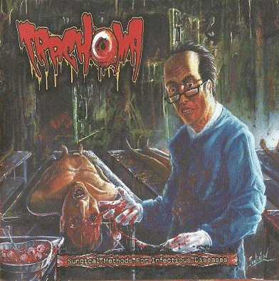 Trachoma : Surgical Methods for Infectious Diseases